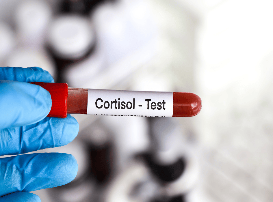kortizol krvný test skúmavka