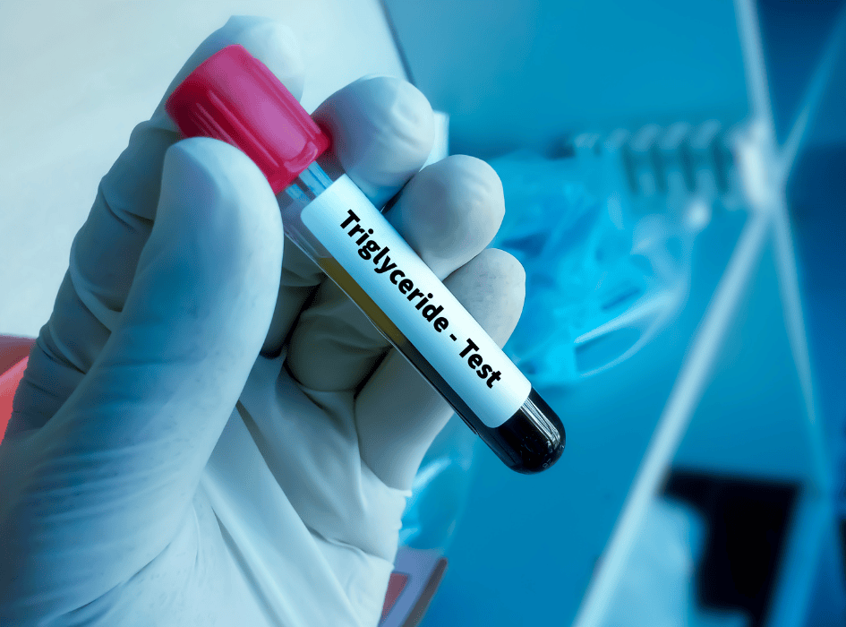 krv v skúmavke s nápisom triglyceridy test-alt