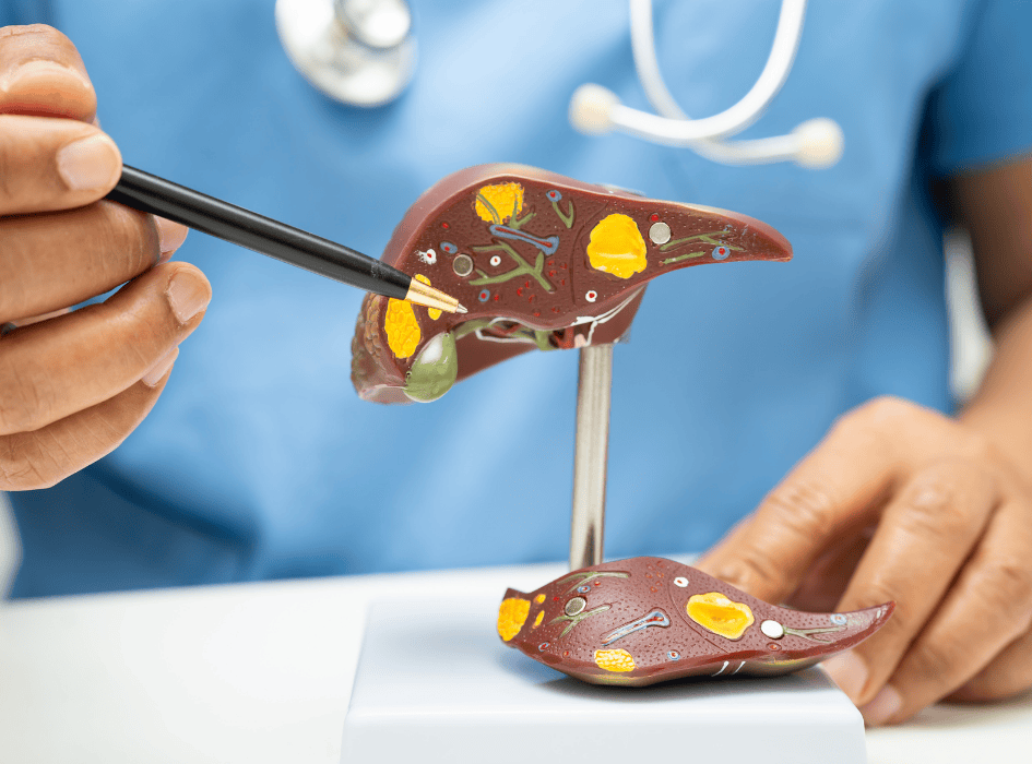 lékař ukazuje na maketu jater a tuky-cz-alt