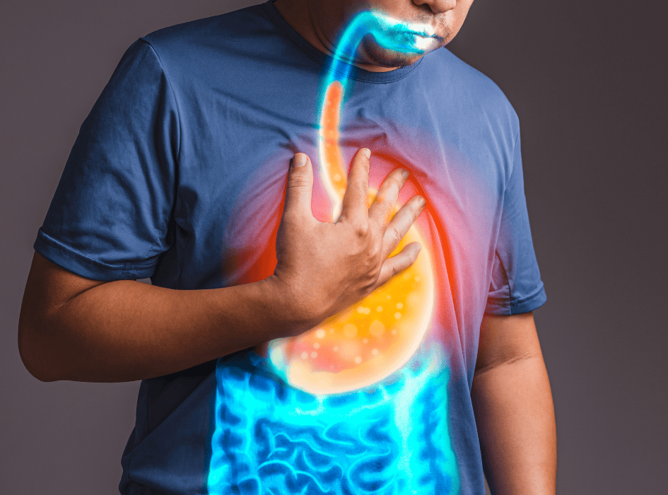 muž má pálenie záhy po prejedení sa-alt