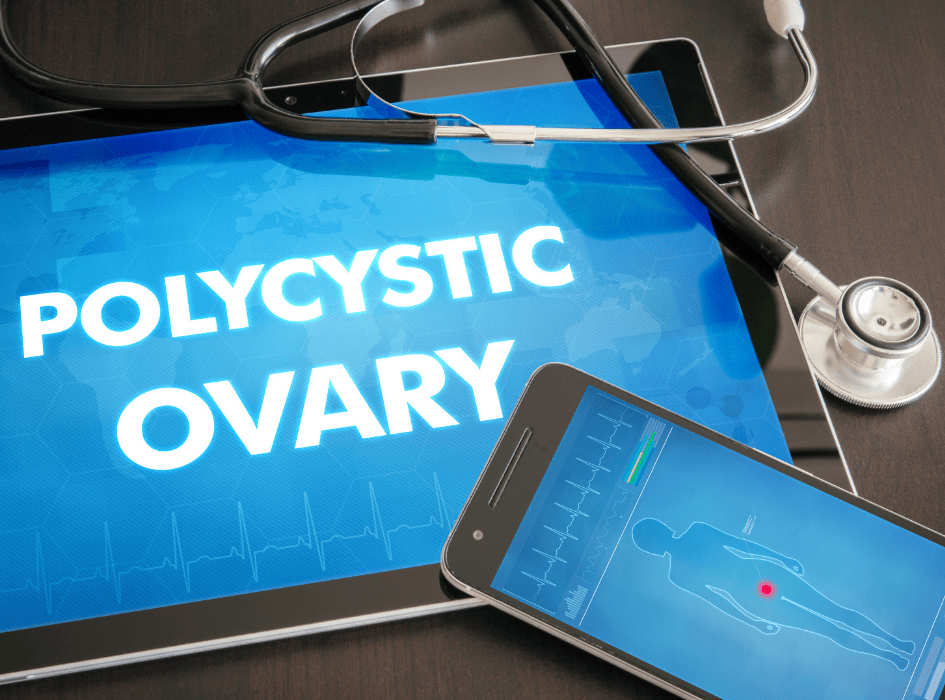 polycistické vaječníky, polycystic ovary a stetoskop, mobil a tablet-alt