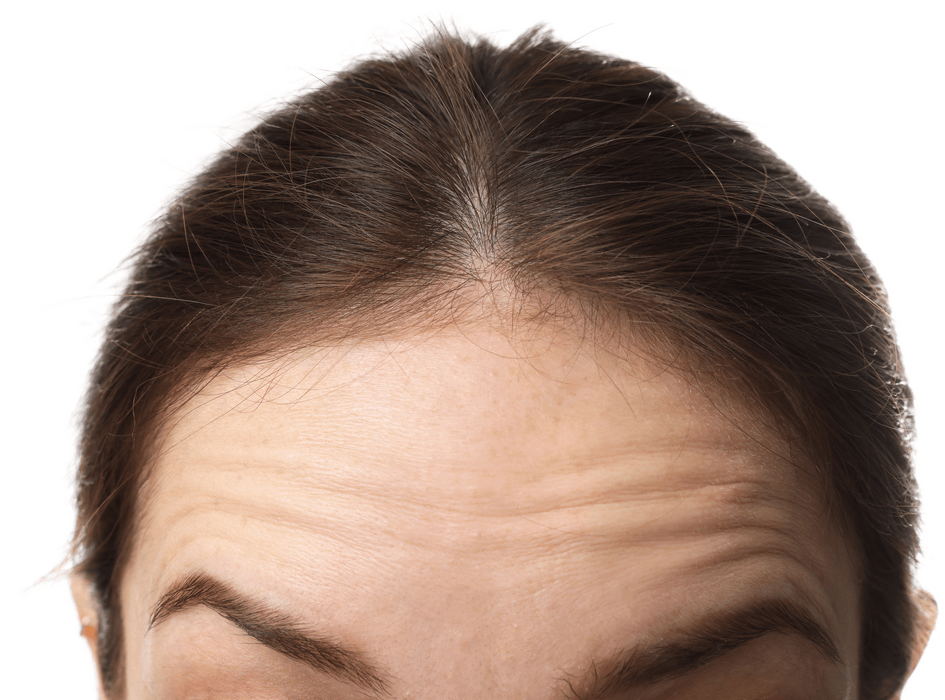 zmarszczki i linie stresu na czole