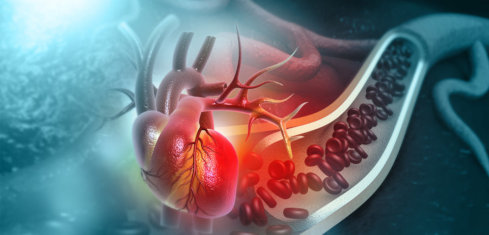 Kardiovaskulárne ochorenie ako strašiak dnešného ľudstva: Ako mu môžeme predísť?
