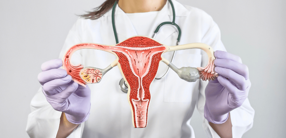 Aké príznaky naznačujú PCOS a aká je liečba polycystických vaječníkov?