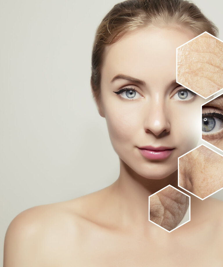 Hialuronska kislina - njeni učinki in kako jo pridobiti