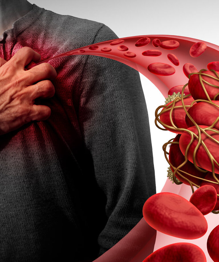 Cholesterol a triacylglyceroly