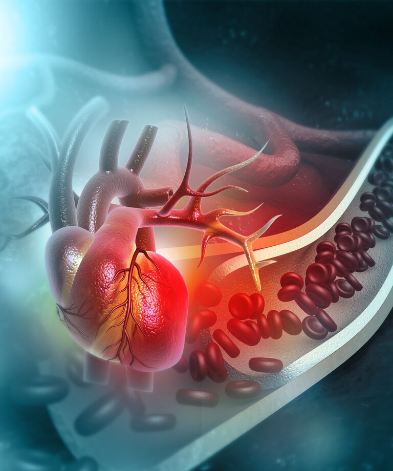 Choroby układu sercowo-naczyniowego są częstą przyczyną zgonów na świecie: jak możemy temu zapobiec?