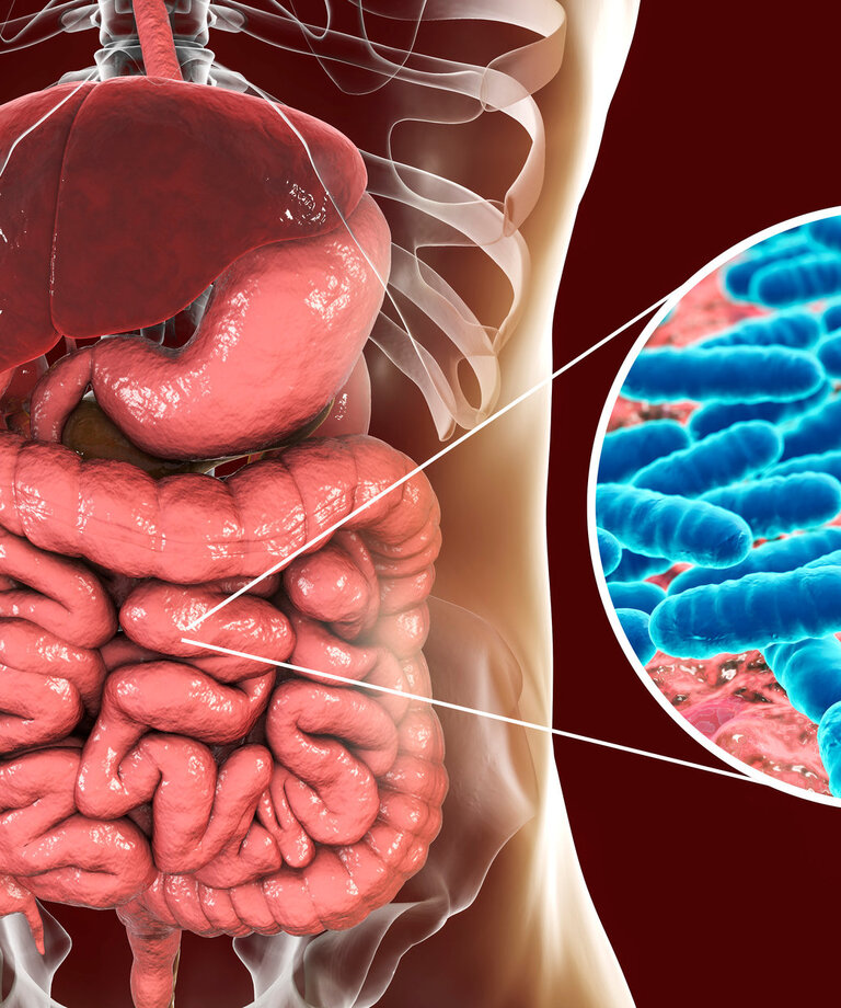 Crohnova bolezen - črevesna bolezen