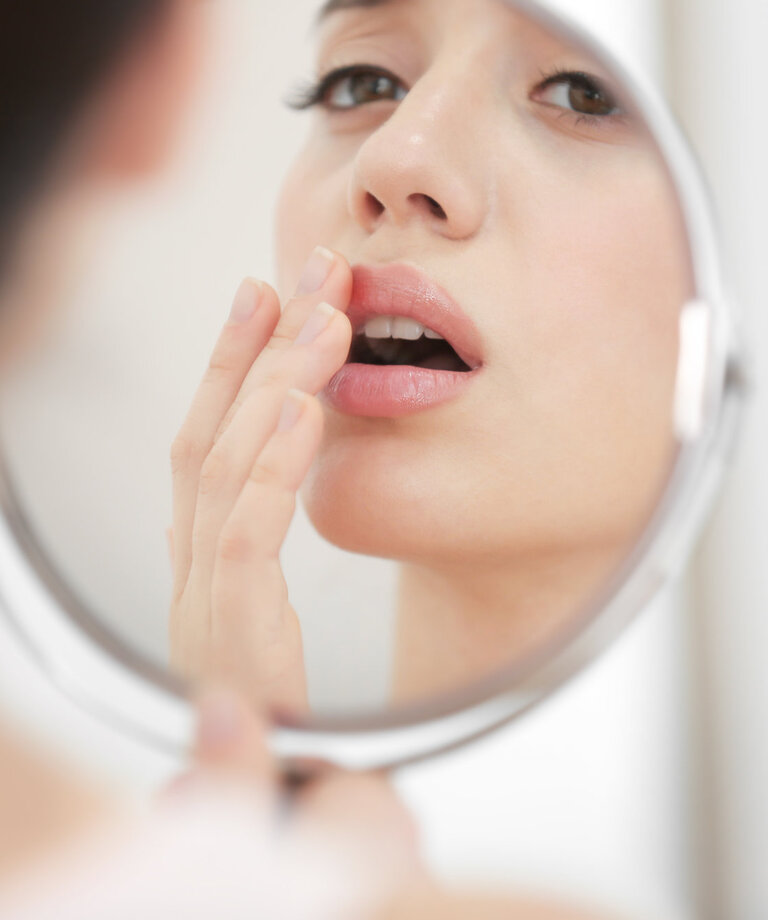 Herpes - boľavé pľuzgieriky na tvári