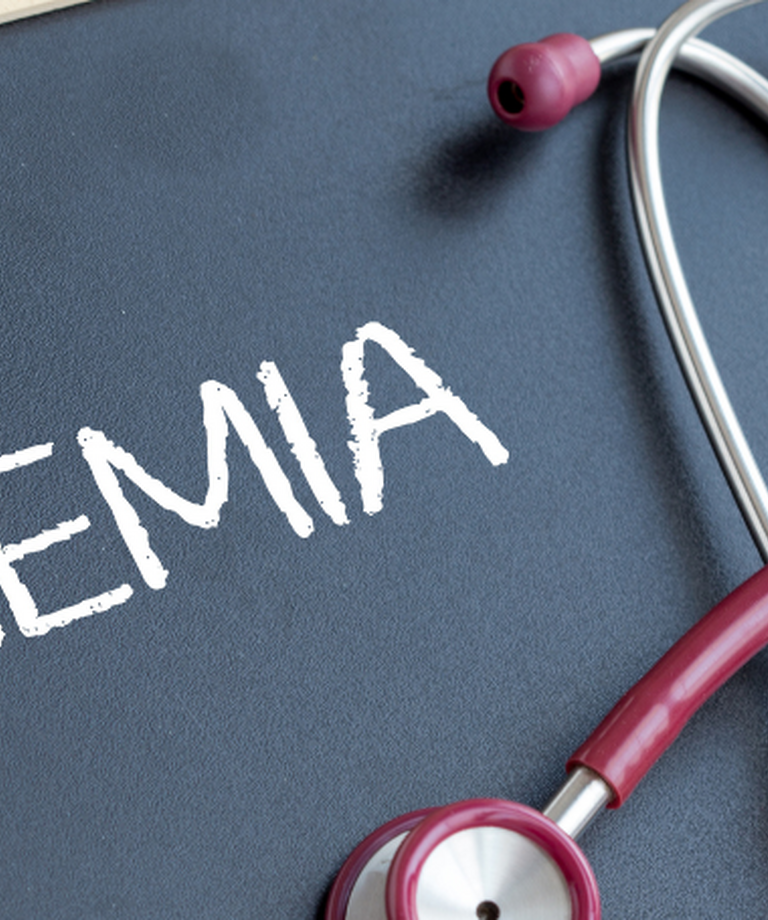 Anemija: Simptomi, vzroki in zdravljenje