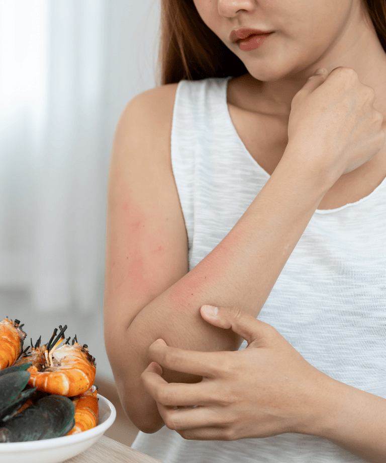 Každý piaty mladý človek trpí intoleranciou alebo alergiou na potraviny