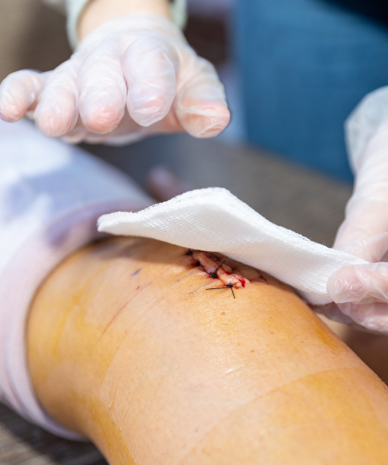 Jak se správně starat o ránu a jak urychlit její hojení?