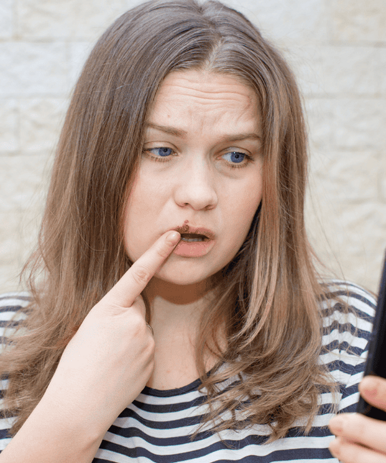 Herpes – příčiny, projevy a účinné způsoby léčby