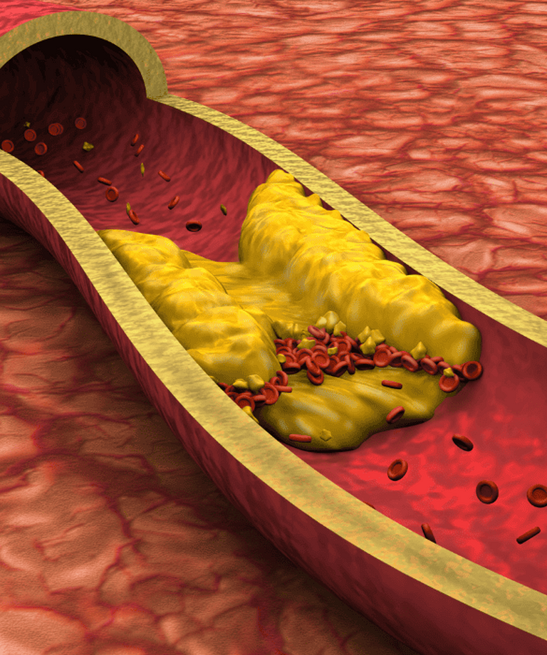 10 mýtů a faktů o Serrapeptáze