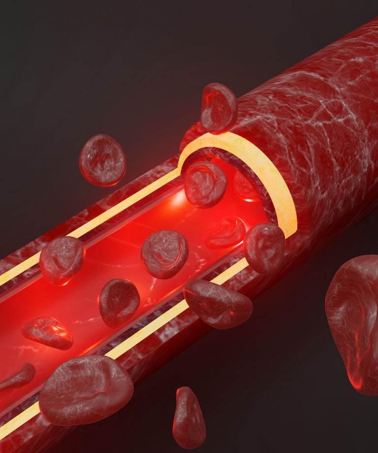 Trombus - nebezpečná krevní sraženina