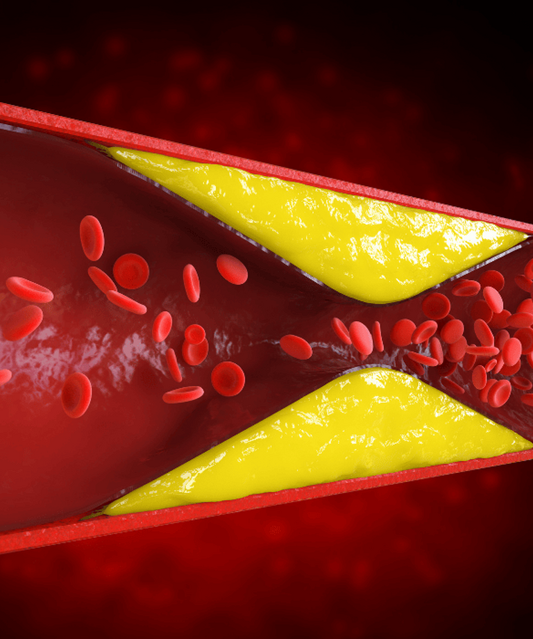 Jak snížit triglyceridy a udržet zdravou hladinu tuků v krvi?