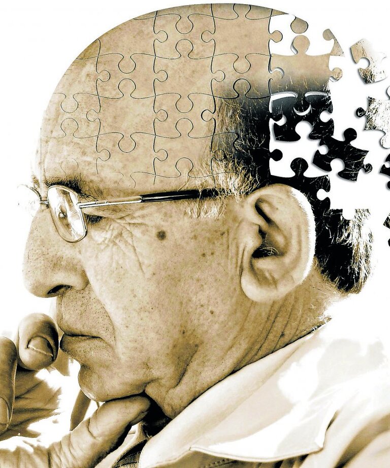 Alzheimerova choroba a její definice