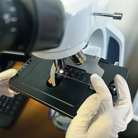 Diagnostika suchej kvapky krvi